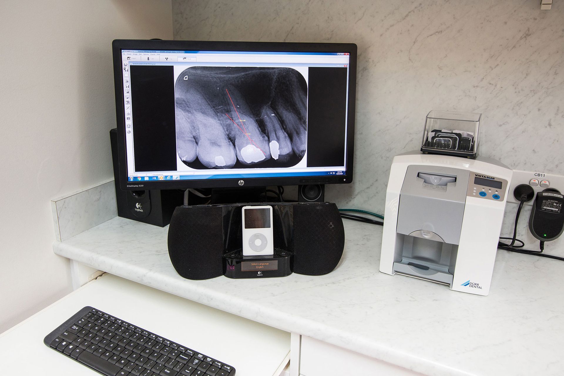 Dental X-Ray Result On The Screen