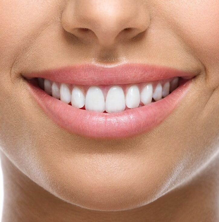 A Close Up Of A Woman's Smile With White Teeth And Pink Lips — Mittagong Dental Care In Mittagong, NSW