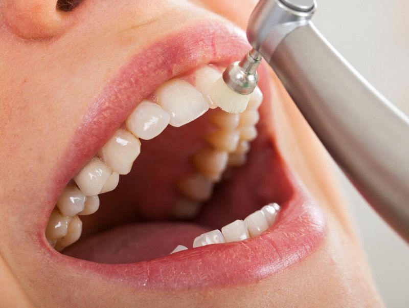 A Woman Is Getting Her Teeth Cleaned By A Dentist — Mittagong Dental Care In Mittagong, NSW
