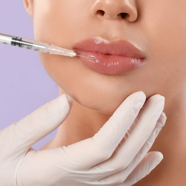 Gloved hands inject filler into a person’s lips with a syringe against a lavender background