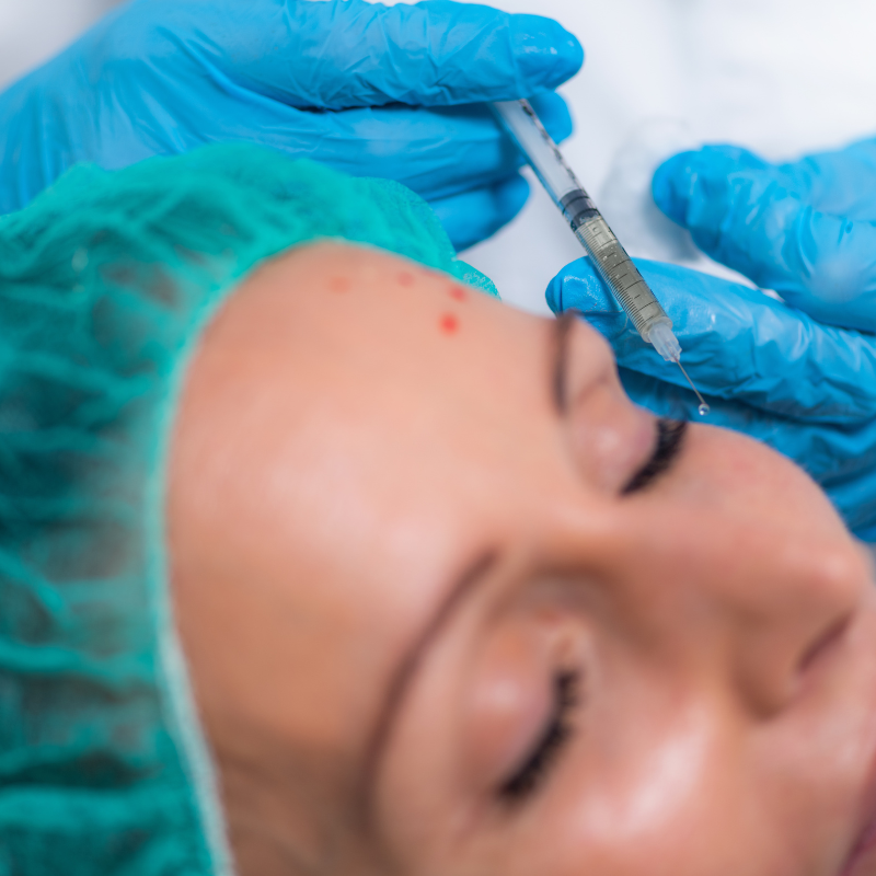 Aesthetic treatment with a gloved clinician injecting a needle into the forehead near the eyebrow