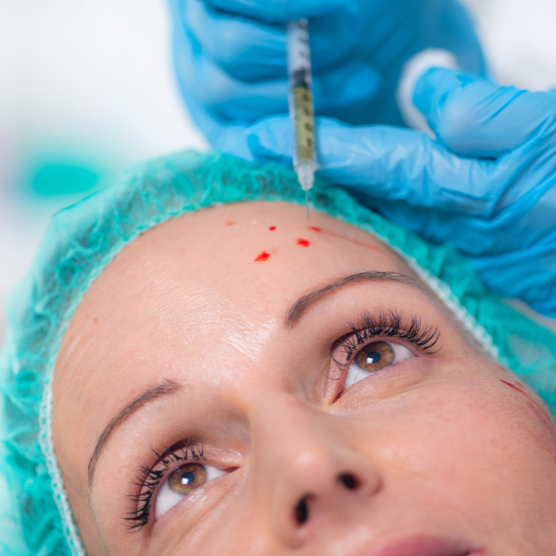 Cosmetic procedure marking dots on a forehead with a medical pen and gloved hands