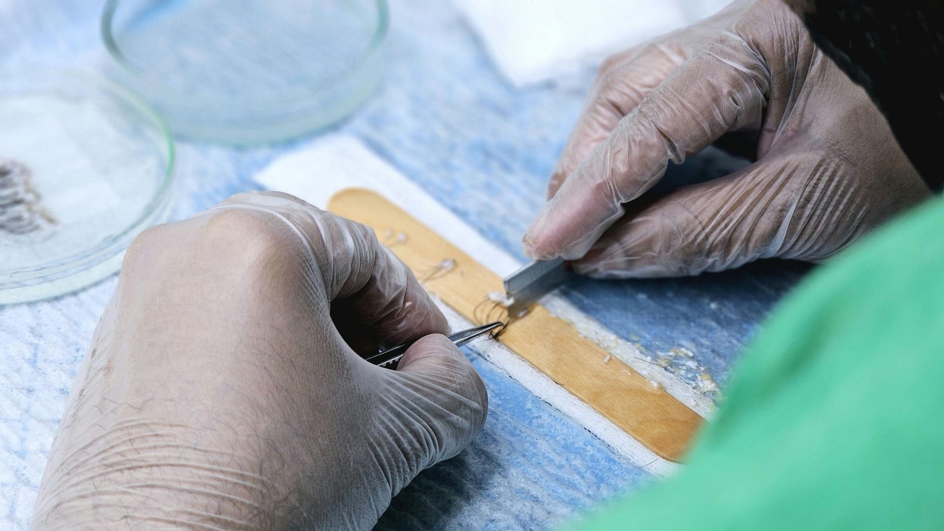 Gloved hands measuring a small wound with a ruler on a blue surgical drape