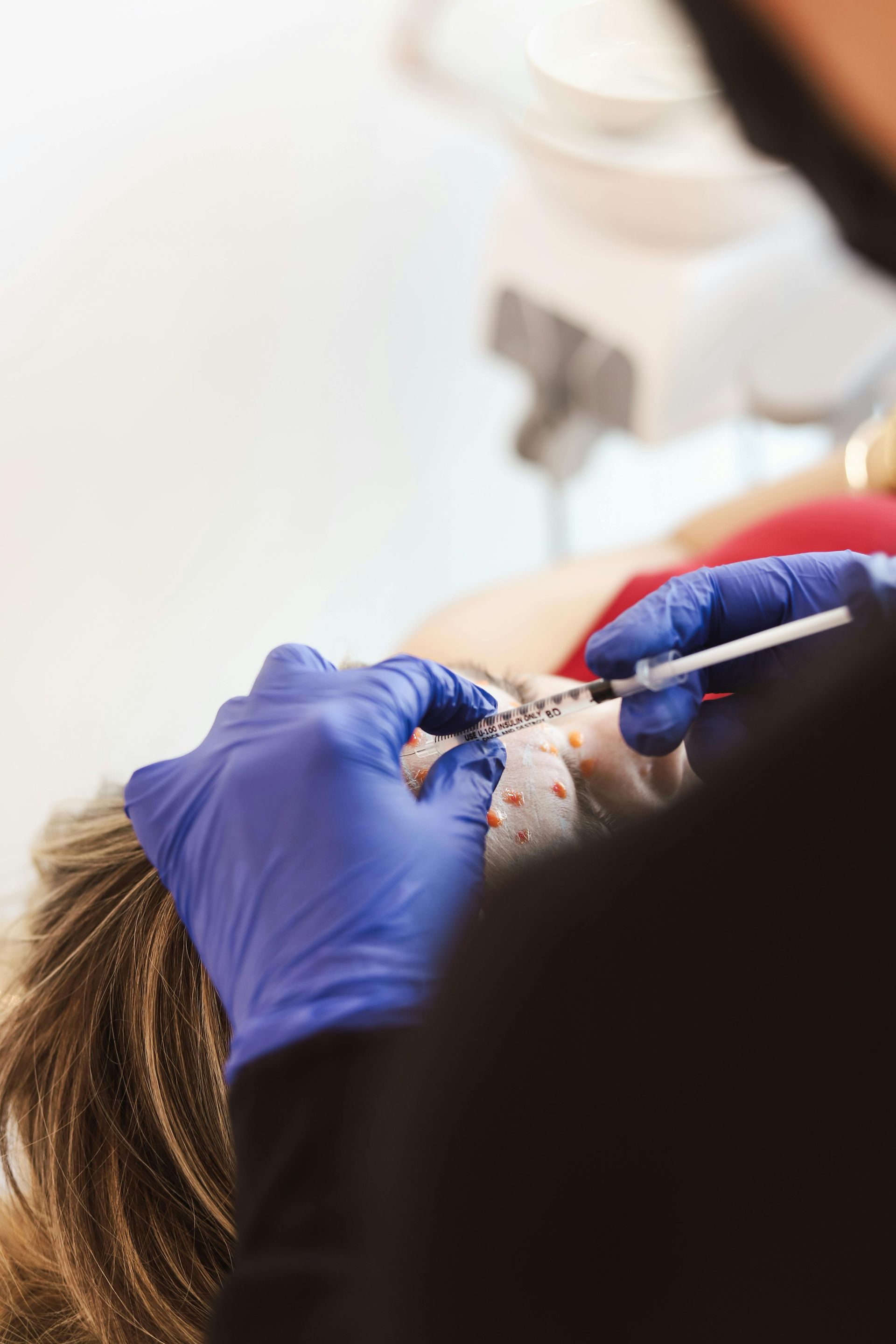 Gloved hands inject filler into a person’s lips with a syringe against a lavender background