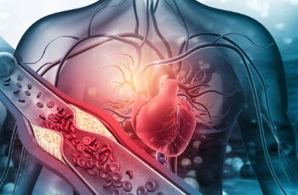 DR. JOSÉ R. AMAVIZCA MARTÍNEZ CLÍNICA CARDIOVASCULAR - Angiología