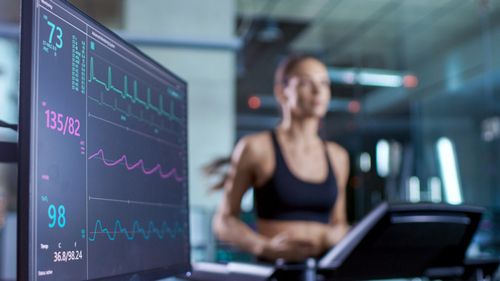 DR. JOSÉ R. AMAVIZCA MARTÍNEZ CLÍNICA CARDIOVASCULAR - Prueba de esfuerzo