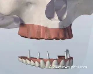 A computer generated image of a skull and teeth