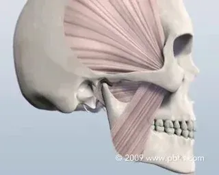 tmj disorder