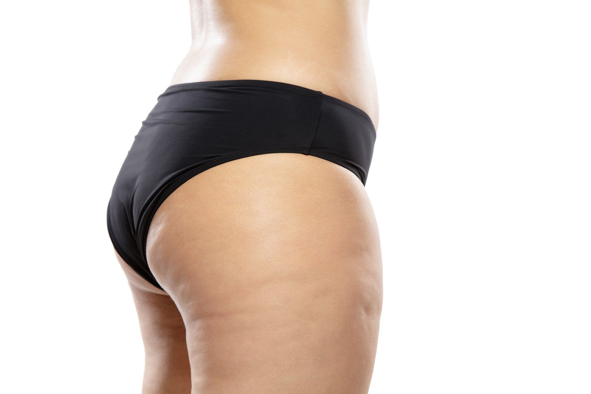 Cómo quitar la celulitis Cómo quitar la celulitis