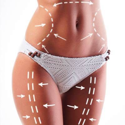 Abdomen femenino con marcación de zona para moldeo corporal