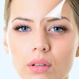 Antes y después de tratamiento estético en el contorno de ojos