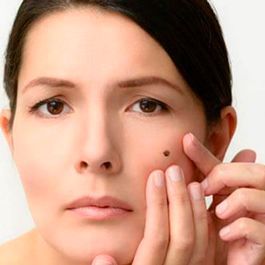 Mujer con lunar en el rostro