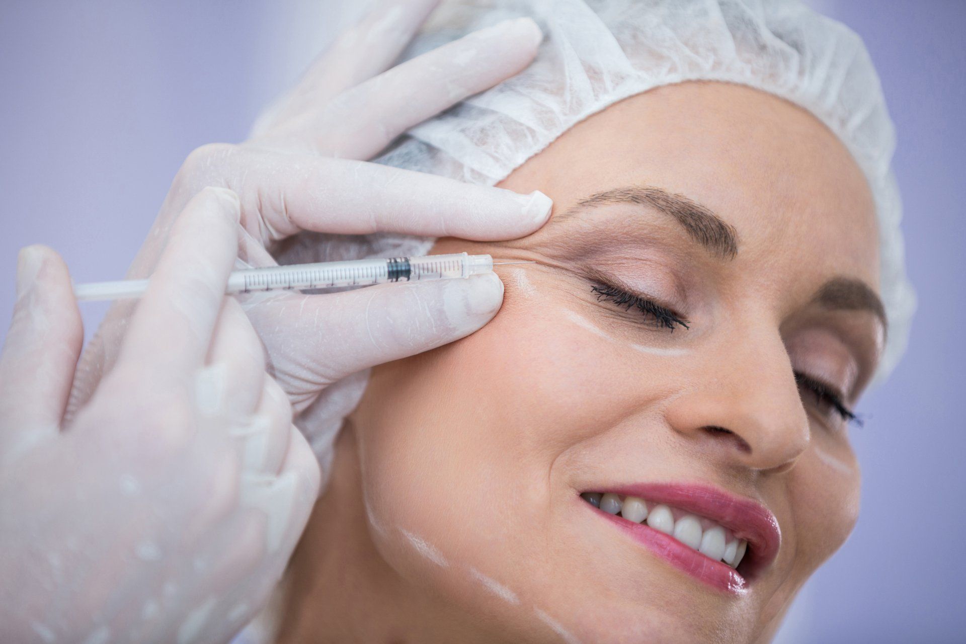 Mitos y verdades sobre el botox