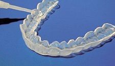 Allineatori dentali trasparenti su sfondo blu