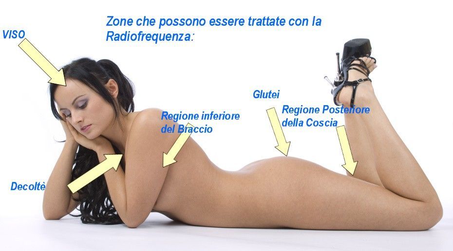 Persona sdraiata su un tavolo bianco con etichette che indicano le aree di trattamento a radiofrequenza su sfondo blu.