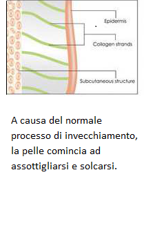 Diagramma della pelle che mostra assottigliamento e solchi con l’invecchiamento, con etichette su epidermide e collagene