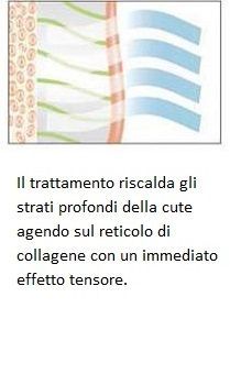 Diagramma di trattamento cutaneo con strati della pelle e linee blu, testo italiano sull’effetto tensore del collagene