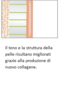 Diagramma in italiano con pelle migliorata grazie alla produzione di nuovo collagene.