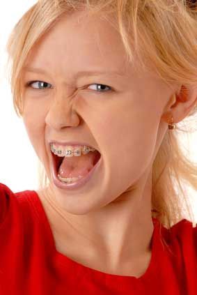Primo piano di un bambino sorridente con l'apparecchio, che indossa una maglietta rossa e ha un'espressione giocosa.