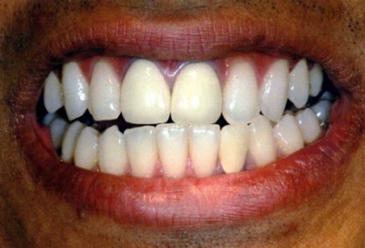 Primo piano di una bocca sorridente che mostra denti e labbra bianchi