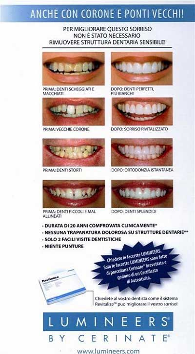 Pubblicità italiana di un'odontoiatria che mostra foto del prima e dopo di denti trattati con apparecchi ortodontic