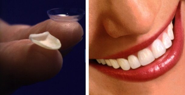 Lente a contatto e bocca sorridente con denti bianchi su un primo piano di labbra rosse.