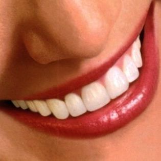 Primo piano di una bocca sorridente con rossetto rosso lucido e denti bianchi
