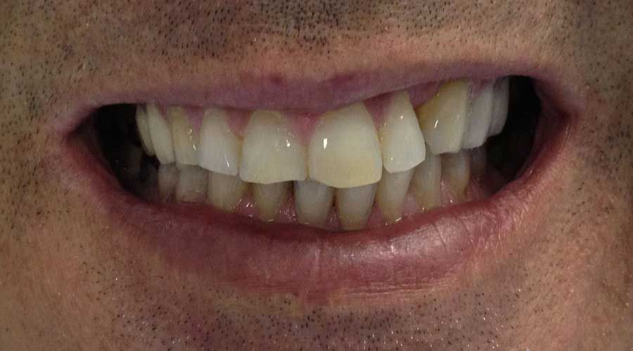 Primo piano di una bocca sorridente che mostra denti e labbra.