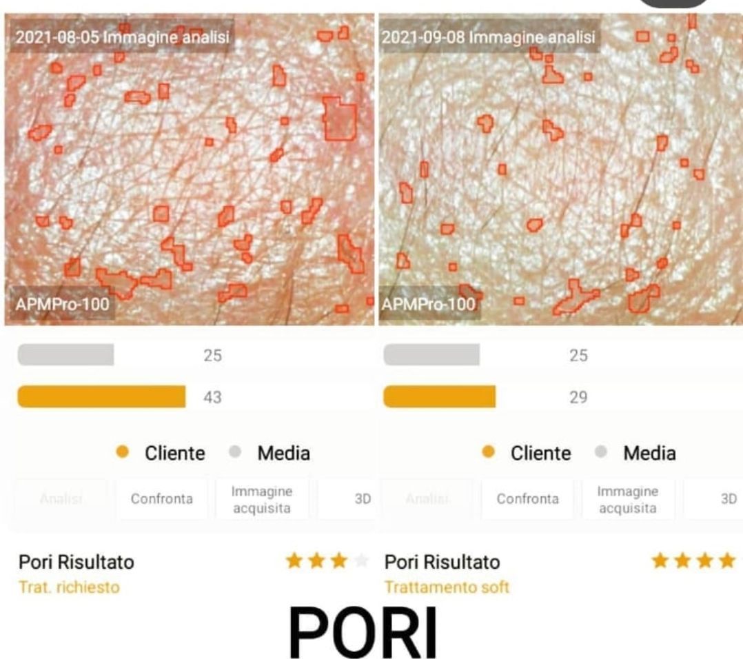 analisi della pelle computerizzata