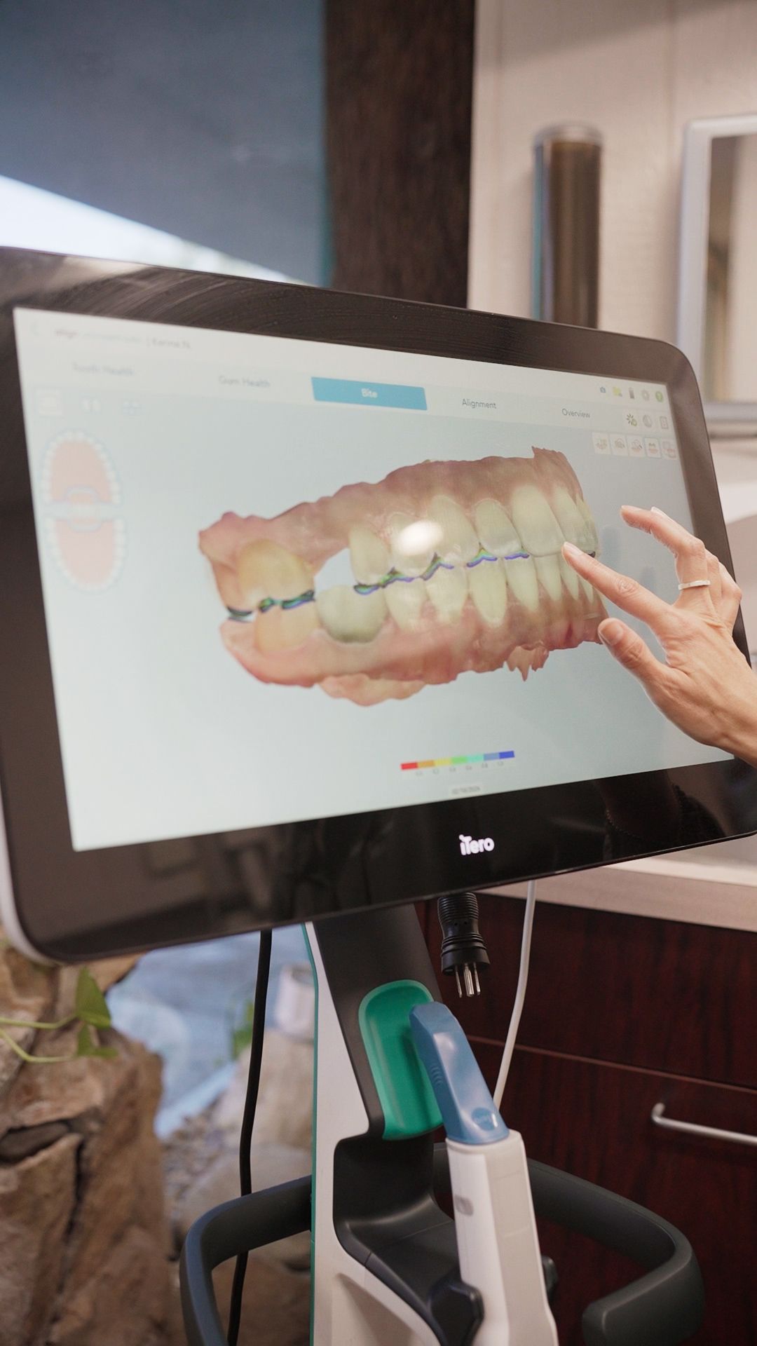 Person points at a dental scan on a touchscreen monitor in a clinic