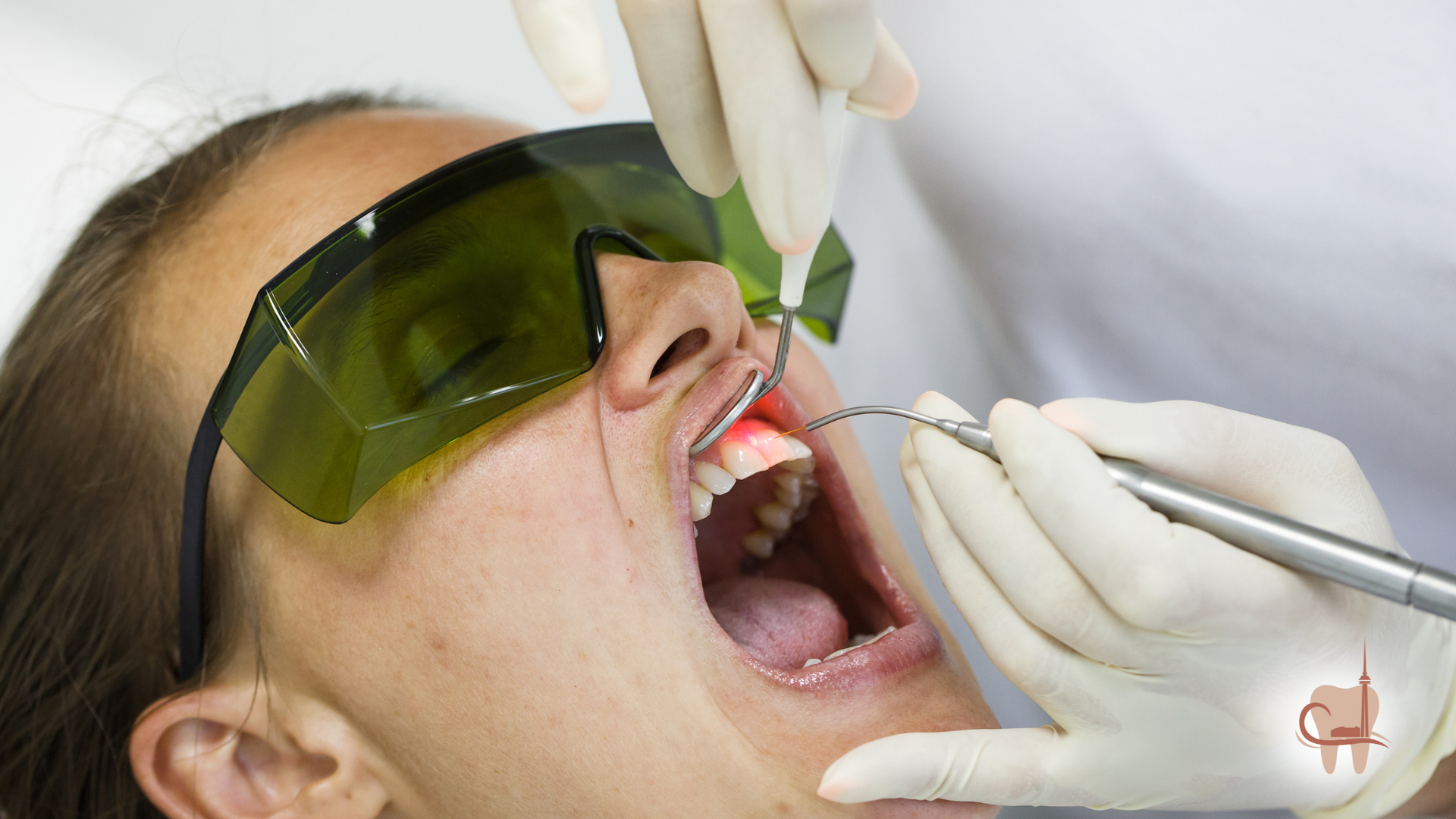 Woman receiving dental laser treatment. Dentist in gloves, safety glasses. Open mouth, red gums.