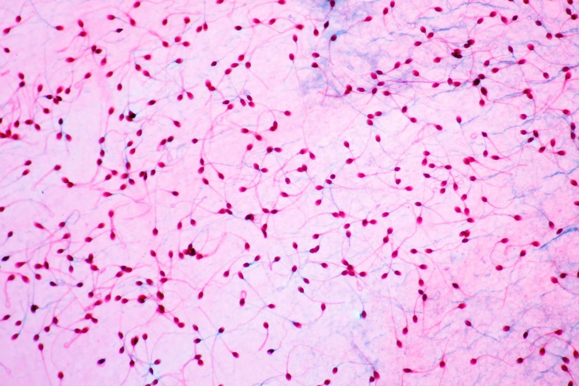 Sperm motility