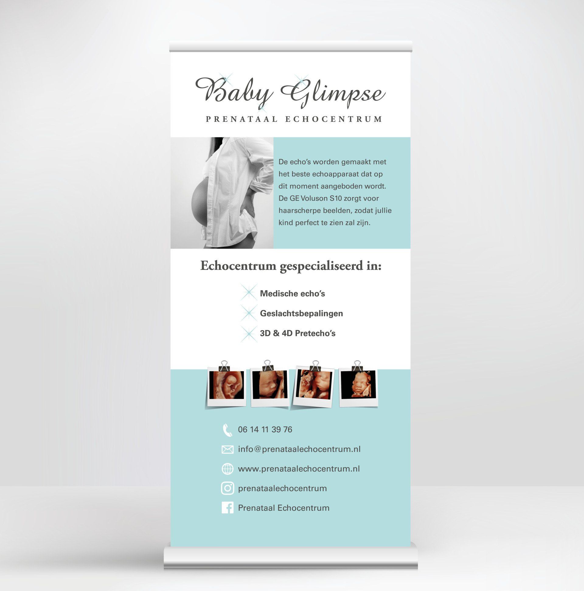 Een promotionele oprolbanner voor de echografie-service 