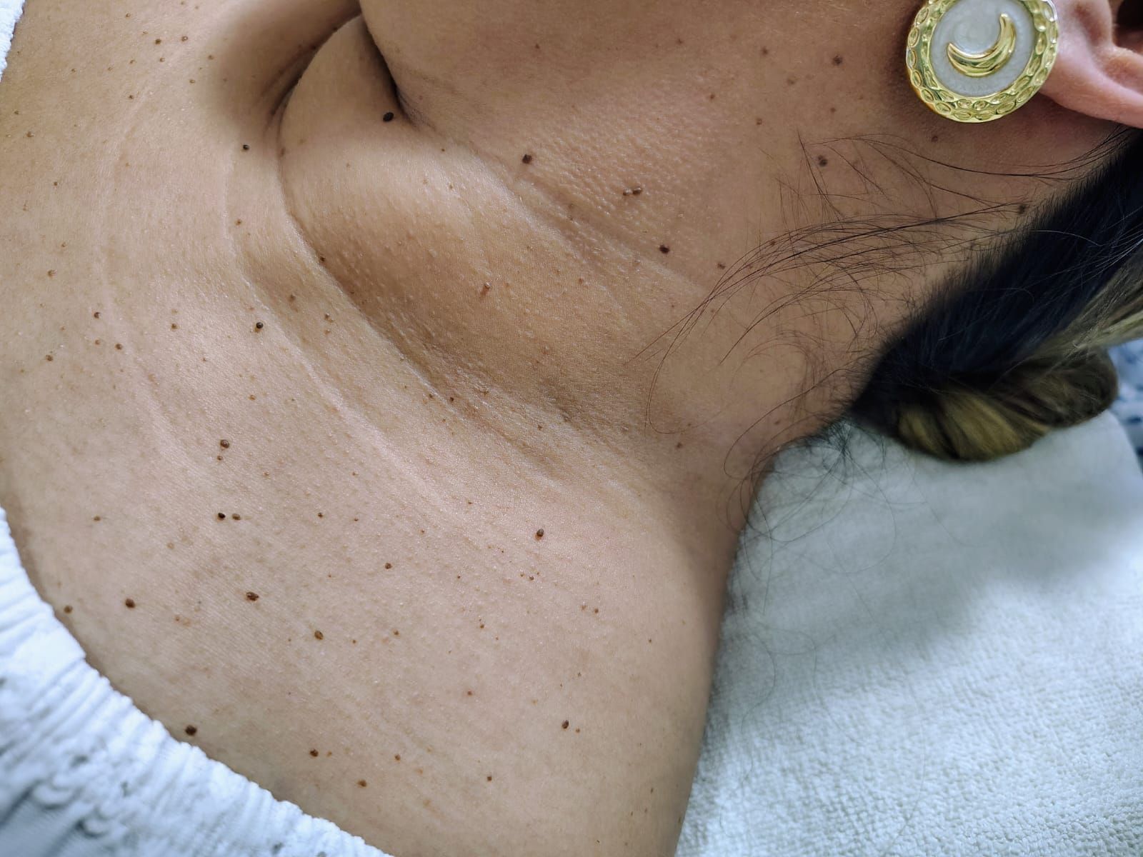 CLARY RAMÍREZ FISIOTERAPIA

