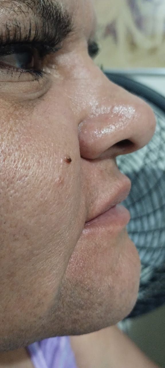 CLARY RAMÍREZ FISIOTERAPIA

