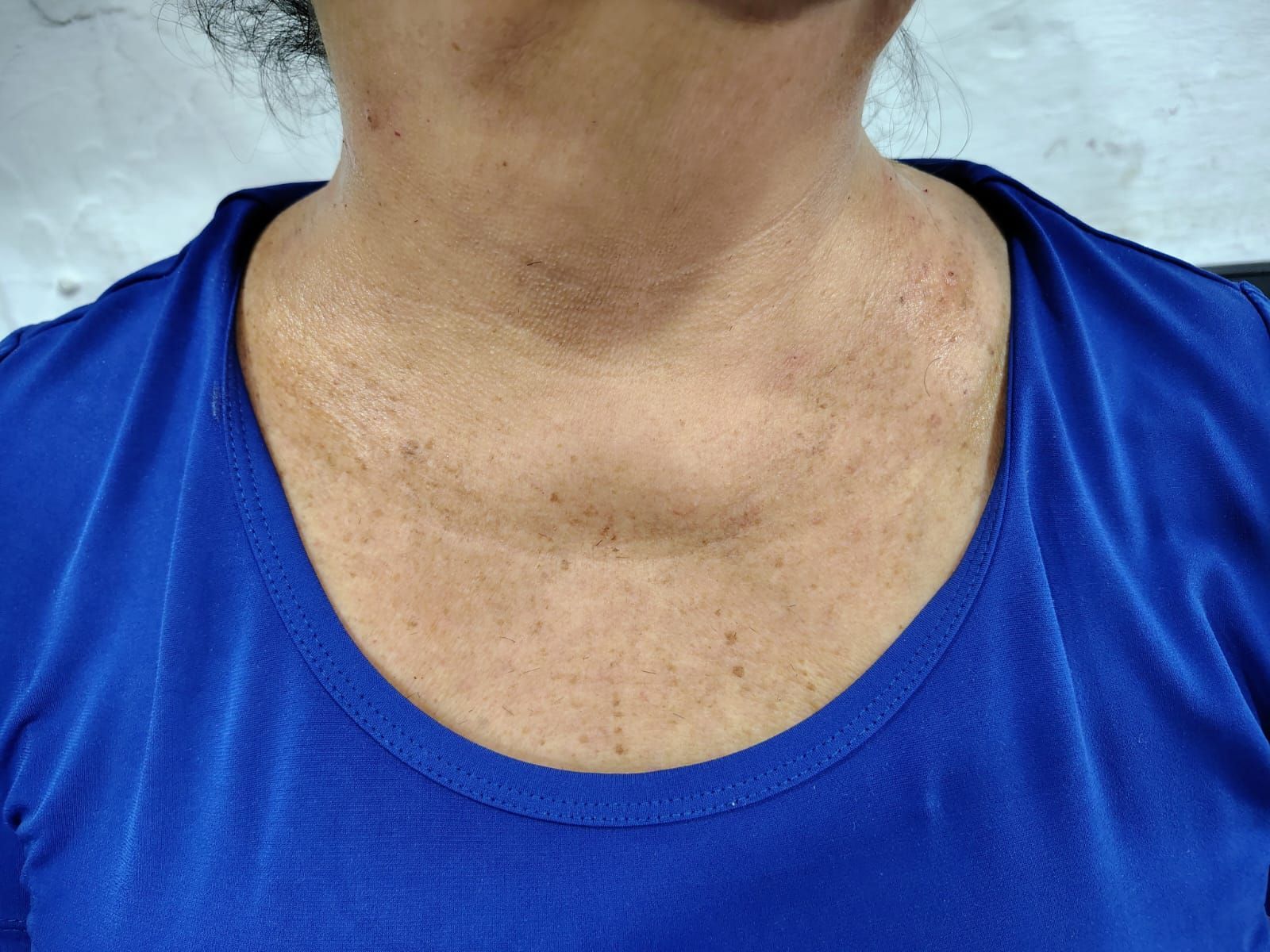 CLARY RAMÍREZ FISIOTERAPIA


