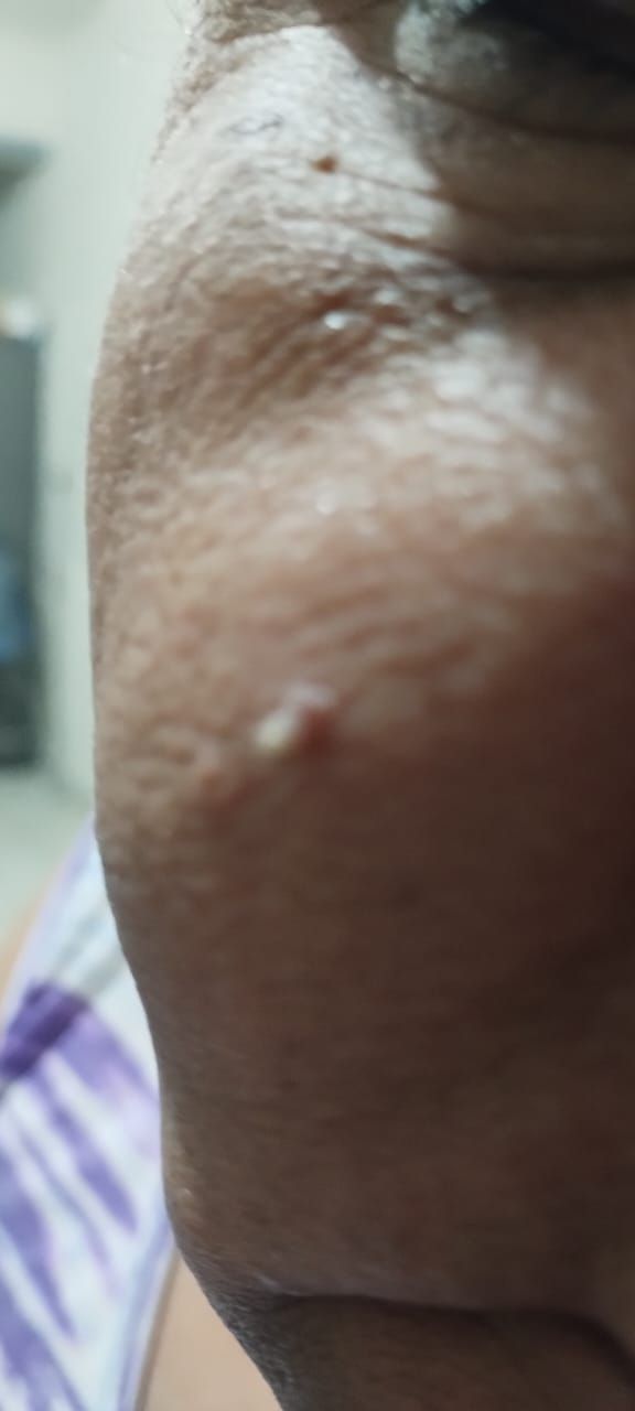 CLARY RAMÍREZ FISIOTERAPIA

