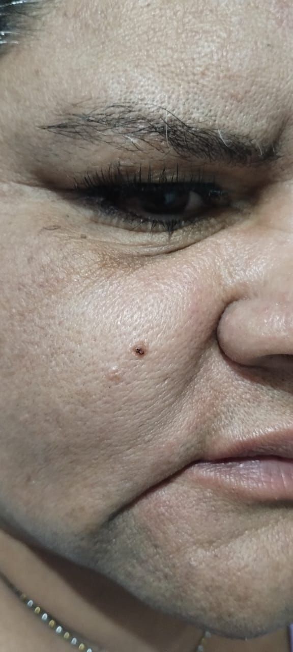 CLARY RAMÍREZ FISIOTERAPIA

