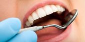 Do I have oral cancer? Mouth open with dental mirror during exam | Oral Cancer Screenings | Dentist near me in Topeka KS