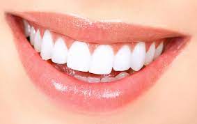 Affordable smile makeovers in Topeka KS woman with perfect smile after getting a smile makeover from our best dentist near Topeka KS