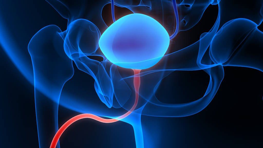 cáncer de uretra