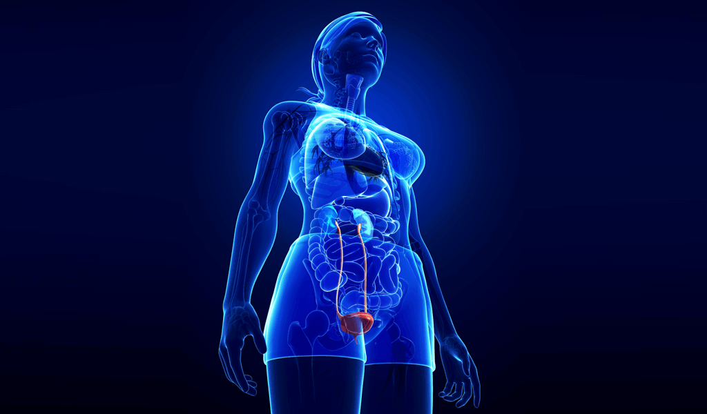 Cáncer de vejiga