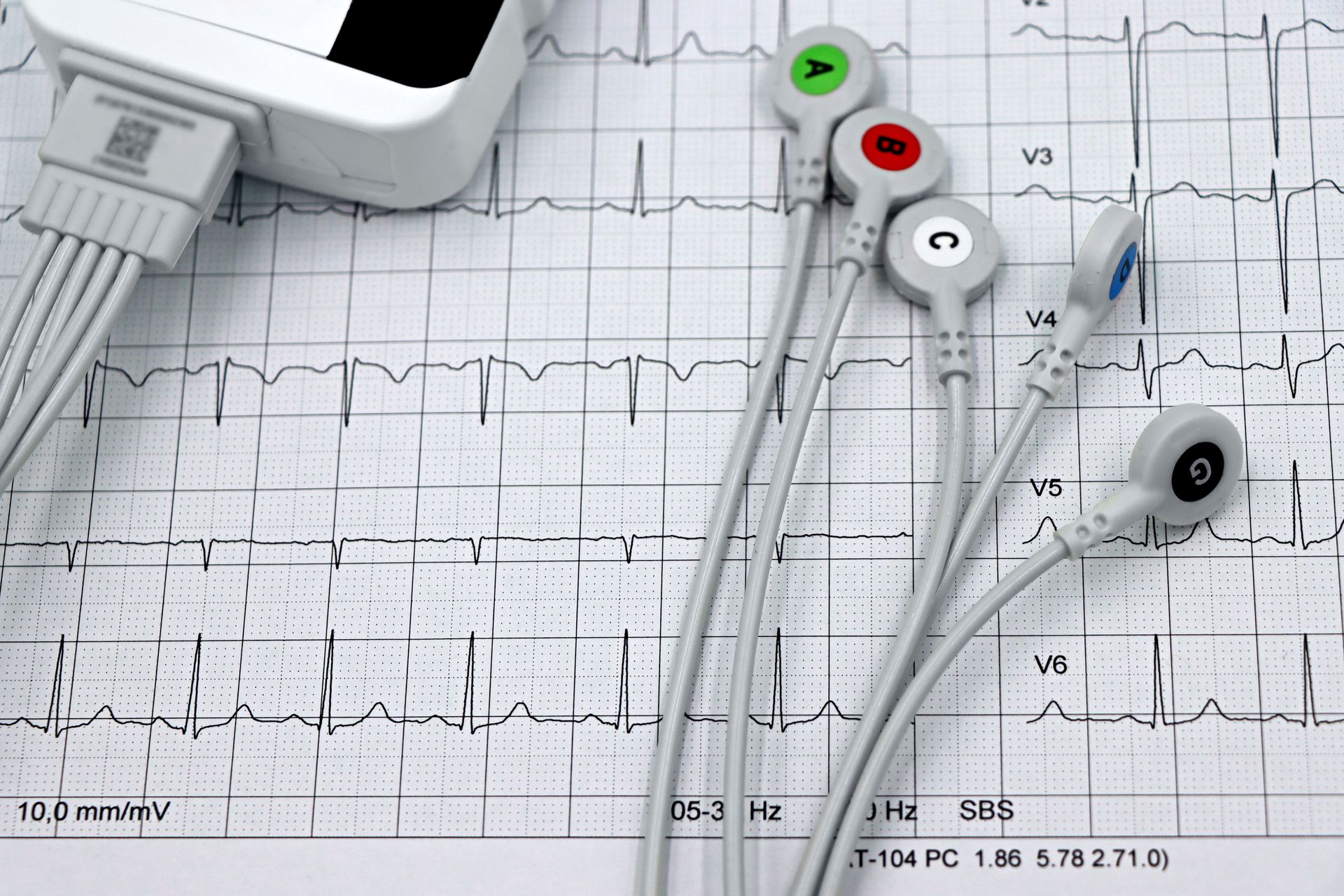 Psychiatric Evaluation Diagnose