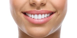 Periodontics — Orthodontic Bracket or Brace in Lexington, KY Periodontics — Orthodontic Bracket or Brace in Lexington, KY