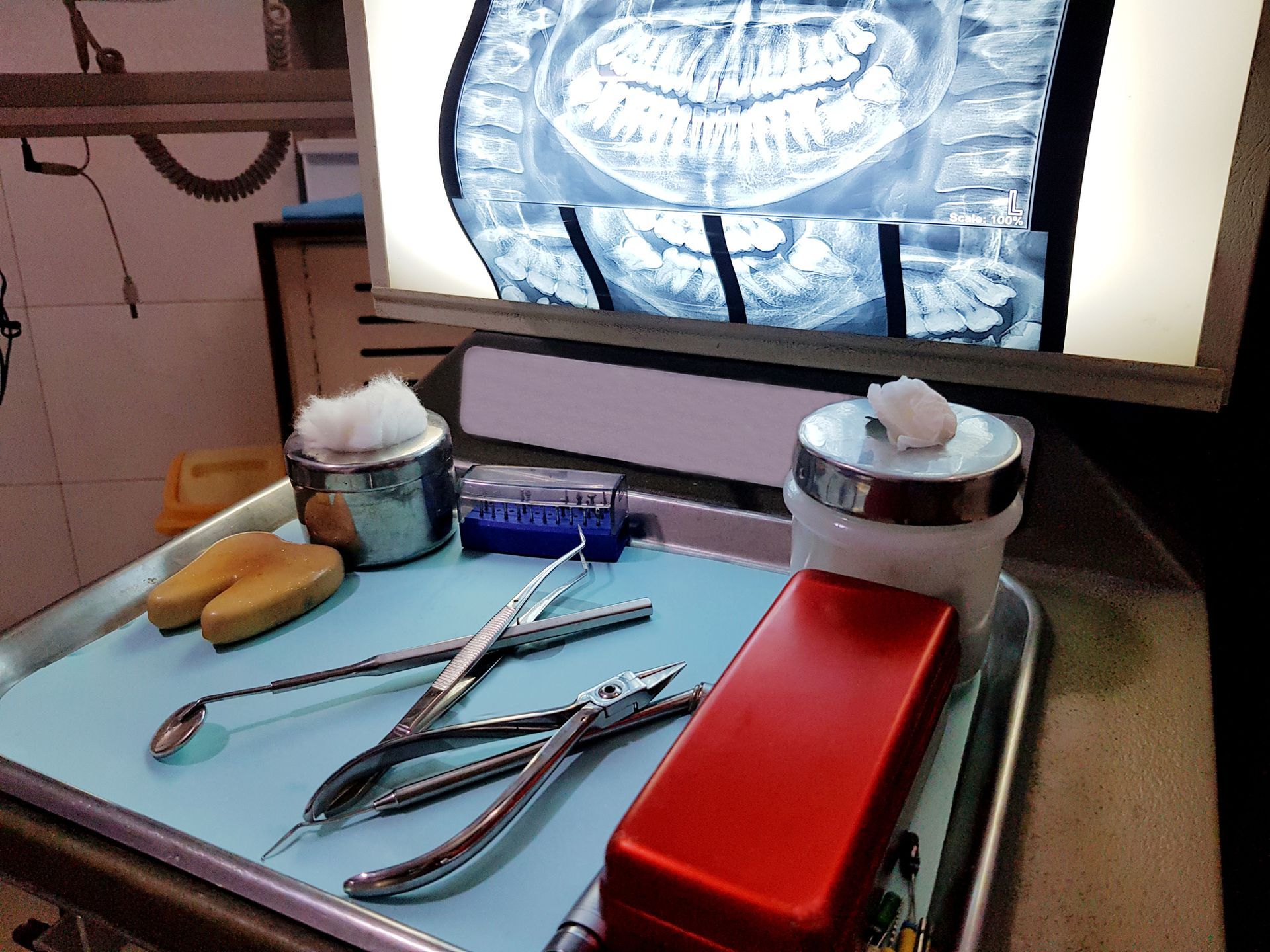 A tray of dental instruments sits in front of an x-ray
