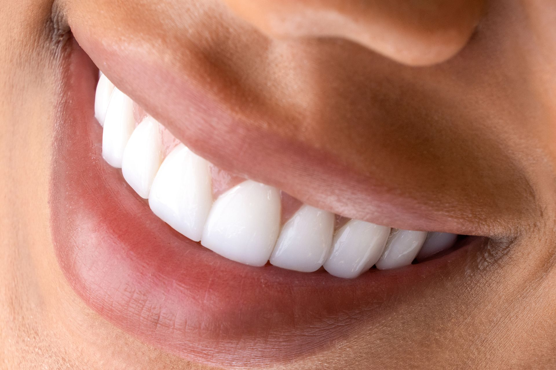 A close up of a person 's smile with white teeth.