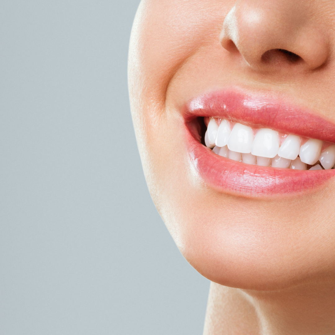 A close-up view of a smiling mouth featuring healthy, white teeth and smooth skin against a plain grey background.