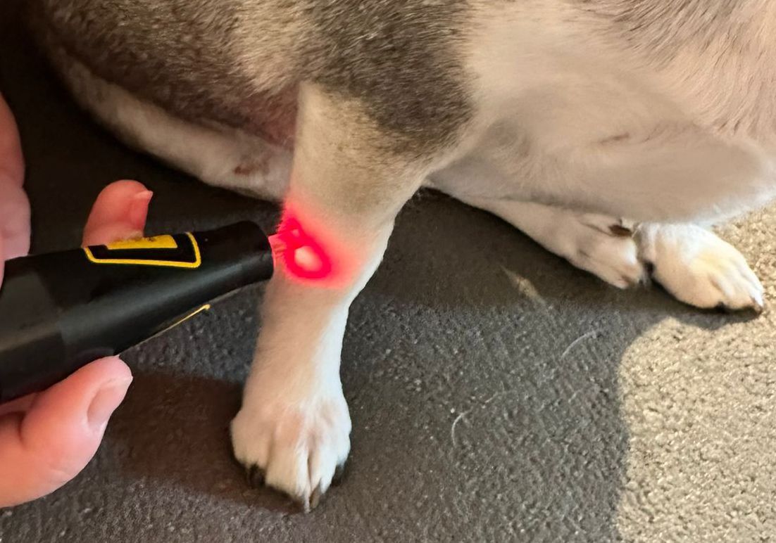 Laserakupunktur