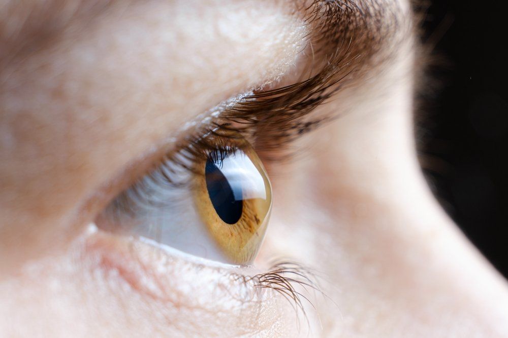close up of eye with keratoconus