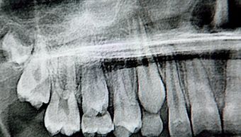 Dental X-Ray — Quincy, MI — Family Dental Home